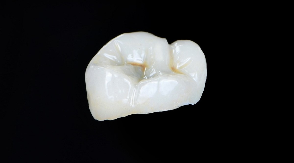 Epsilon Dental Clinic, estetik diş hekimliği, mikroskop destekli diş hekimliği, restoratif diş hekimliği, endodonti, protetik tedaviler, ortodontik tedaviler, cerrahi diş tedavileri, lamine diş, yaprak lamine, çene eklemi tedavileri, çocuk diş hekimliği, periodontal tedaviler, kompozit dolgu, diş beyazlatma, implant üstü protez, porselen lamine, kanal tedavisi, inlay onlay overlay, gece plağı, oklüzal splint, ICON rezin infiltrasyon, adeziv diş hekimliği